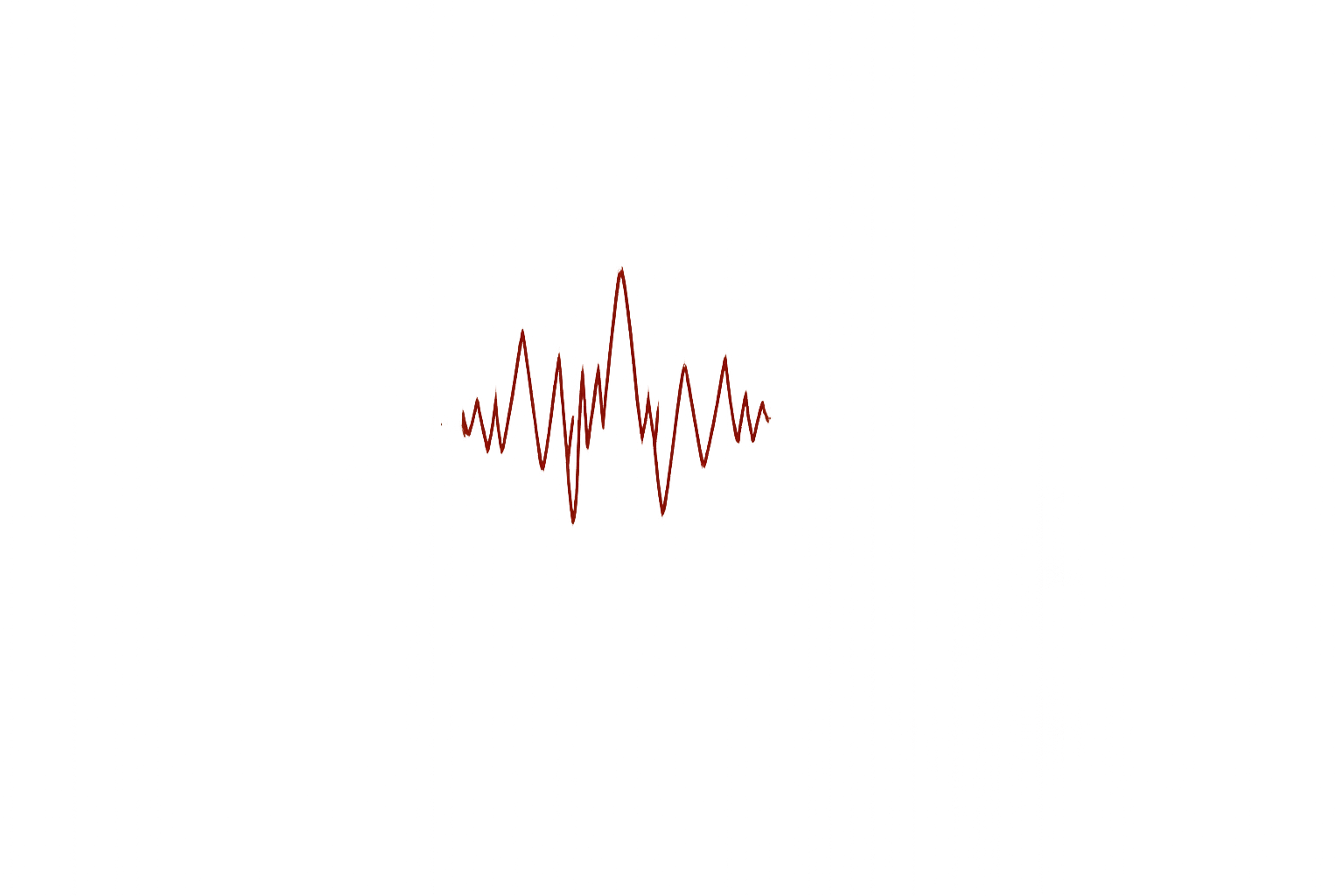 Grafický záznam srdcového tepu zobrazený na rozmazanom pozadí.